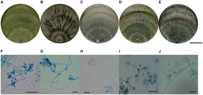 Beneficial and biocontrol effects of Trichoderma atroviride, a dominant species in white birch rhizosphere soil